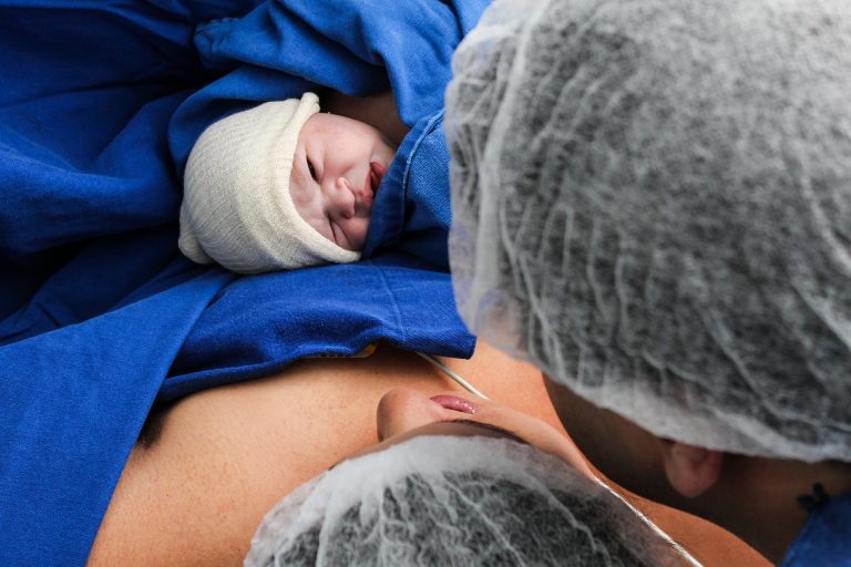 Nacięcie krocza przy porodzie – jak tego uniknąć?